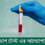 ডোপ টেস্ট এর আদ্যোপান্ত